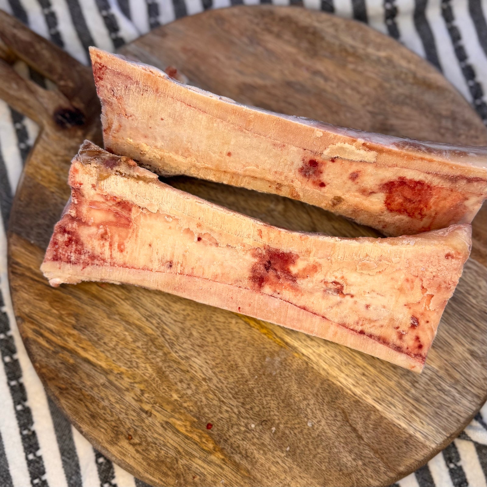 Femur Bones